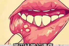 口腔溃疡怎么办#知识分享 #健康 #dou来涨健康知识视频封面