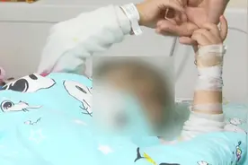 男童误吞25颗磁力珠 腹内串成“手链“致肠穿孔 #直播贵阳视频封面