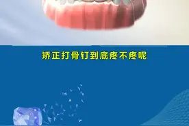 很多人都怕矫正打骨钉，其实打骨钉并没有那么疼哦#口腔科普 #牙齿矫正 #郑州