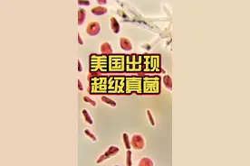 美国疫情还未结束又出现超级真菌！不要慌，听我给你讲讲这个耳念珠菌到底是个什么！觉得视频有用可以点赞转发#美国出现超级真菌 #美国 #美国疫情 