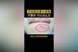 月经前后爱长痘痘？不要挤，可以这么办#痘痘 #皮肤 视频封面