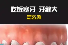 #轻知识计划 吃饭总塞牙，怎么解决呢，你还有什么想知道的？🤔🤔🤔@抖音短视频视频封面