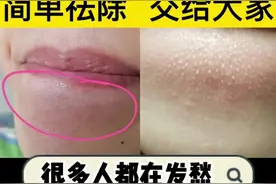 下巴摸着的小疙瘩，和你想的一样吗？#科普 #涨知识 视频封面
