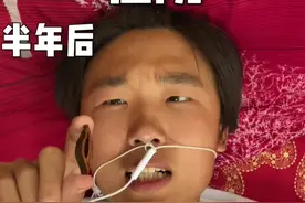 刚吃槟榔和半年后的样子。你们属于那种状态？#搞笑 #槟榔视频封面