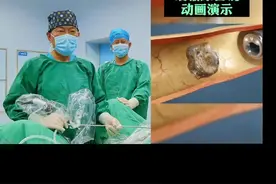 #医学科普视频 #泌尿外科科普 #输尿管镜钬激光碎石术 视频封面