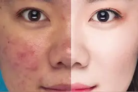 #ps 我最喜欢的痘痘 证件照修图