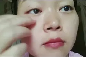 眼角长了1个脂肪粒，一女子居然自己用针给挑了！！视频封面