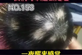 突然头上秃了一块头发，不要慌，这可能是#斑秃 ，可以这么办视频封面