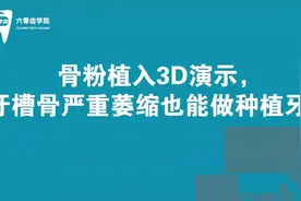 骨粉植入3D演示，牙槽骨严重萎缩也能做种植牙！视频封面