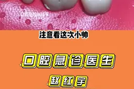 根管治疗蛀牙全过程，听说每个人都有过这种治疗#口腔健康 #根管治疗 #蛀牙 #爱牙护牙 #解说 #医美
