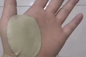 医生拇指根部疼，我的自救！#健康 #科普 视频封面