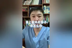 起荨麻疹后怎么办及注意事项
  #荨麻疹 #过敏 #医学科普 
