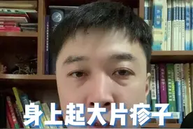 起荨麻疹后怎么办及注意事项
  #荨麻疹 #过敏 #医学科普 
视频封面