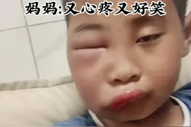 男孩好奇捅蜜蜂窝，被蜜蜂蛰成“包子脸”，妈妈：又心疼又好笑 #熊孩子搞笑日常 #安全 视频来源@莫问前程💗视频封面