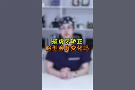 很多人看虎牙不顺眼，想拔掉做矫正，拔虎牙矫正脸型会有变化吗？一起看看吧#dou出新知 #郑州视频封面