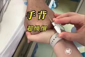 留置针穿刺日常分享……手背，超级细，最近太累了，啥也不想说视频封面