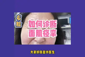 眼皮跳，嘴角抽可不是小事情，可能是面肌痉挛！得治！#面肌痉挛视频封面