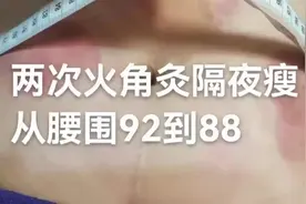 [爱心]肚子大的真正原因： 1、肚脐以上突出是脾虚消化不好。 2视频封面