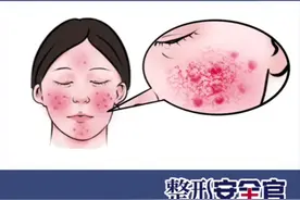 脸部容易发红是什么原因？怎么办？#皮肤 #脸颊发红 #美妆护肤 #皮肤管理 视频封面