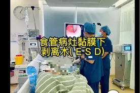 #手术 #食管#内镜手术视频封面