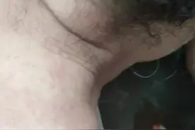 湿疹脖子痒，做一次以后就消炎了，立马做