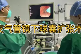 支气管球囊扩张术妙解气道狭窄 #医学科普 #气道狭窄 #介入手术视频封面