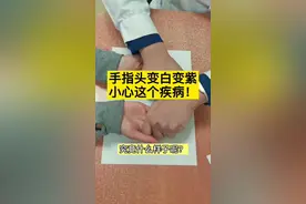 手指头变白变紫小心这个疾病！#健康真相官 #医学科普