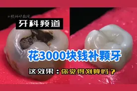 花3000块钱补颗牙，大家看看这效果值吗？#口腔科邓教授视频封面