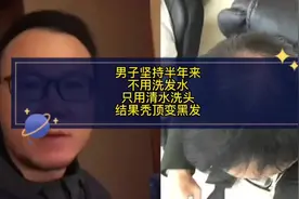 还要啥洗发水？男子半年来坚持只用清水洗头，从秃顶变满头黑发视频封面