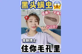 黑头有螨虫⁉️毛孔粗大😱1招自测🔍2招快速去除✅ #螨虫#黑头#毛孔粗大#油皮#祛螨虫#螨虫痘痘#滚蛋吧螨虫君#螨虫脸#酒糟鼻#如何去黑头#去黑头方法#祛黑头#去黑头神器#护肤