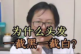 #头发 一截黑一截白这是为什么？