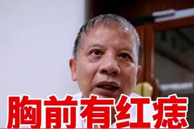 #肝病 #蜘蛛痣 #肝掌 #养肝视频封面