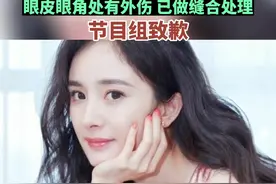 杨幂录制节目时受伤，眼皮眼角处有外伤，已做缝合处理，《密室大逃脱》节目组致歉视频封面