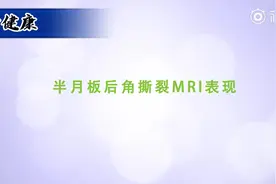 半月板后角撕裂MRI表现---刘玉珂视频封面