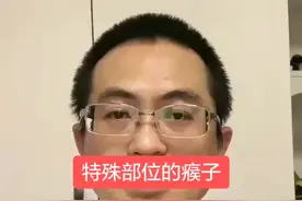 特殊部位的瘊子，怎么办？#健康科普行动 #健康科普排位赛 @颜值科学社 @DOU+小助手视频封面