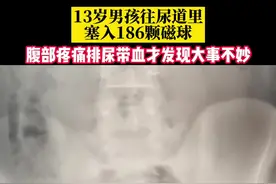 近日，广东深圳，13岁男孩往尿道里塞入186颗磁球，腹部疼痛排尿带血才发现大事不妙！#隔着屏幕都觉得疼 视频封面