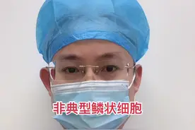 宫颈癌筛查提示非典型鳞状细胞#医学科普视频封面