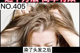 染了头发过敏，越抓越痒怎么办 #染发 #过敏 #头发护理 视频封面