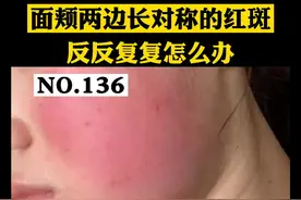 脸上长对称的红斑，反反复复，持续不退，有什么办法可以处理吗？#玫瑰痤疮 #晒伤 #皮肤 视频封面