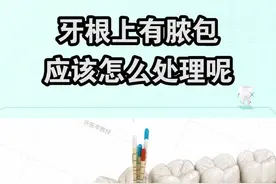 牙根有囊肿，该怎么处理呢？一起看看#dou来护牙 #口腔科普视频封面