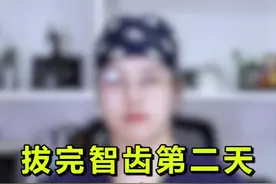 拔牙后第二天，嘴里还是不舒服，怎么办呢？一定要注意这4点哦#dou是知识点 #轻知识计划视频封面