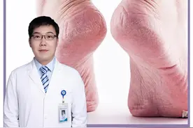 脚后跟粗糙开裂，别再用锉刀来磨脚了，皮肤科医生这里有妙招~#樊哥撩皮肤#手脚干裂 #瑶零零计划 #女性健康计划 