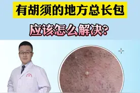 胡子上长脓包，试试这样处理#医学科普 #皮肤 #脓包 视频封面