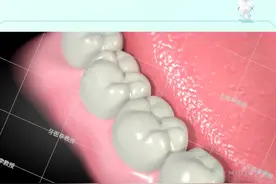 最常见的三种牙疼症状,龋齿，牙髓牙炎，智齿冠周炎，你有过这些牙疼经历吗？#牙疼 #爱护牙齿 #口腔科普视频封面