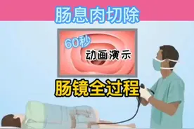 动画演示肠息肉切除及肠镜全过程#上热门 #息肉 #肠镜 #肠癌