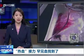 #稀有血型 #无偿献血 历时33小时的极稀有血型血液保卫战视频封面