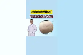 宝宝长了荨麻疹，特别痒怎么办？#医学科普 #皮肤 #荨麻疹 视频封面