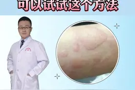 宝宝长了荨麻疹，特别痒怎么办？#医学科普 #皮肤 #荨麻疹 视频封面