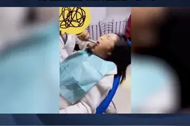 太夸张！#女子拔智齿牙医生拉硬拽摇晃1小时：打了麻药，不疼视频封面