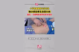 十岁男童胸部长出包块，确诊感染寄生虫裂头蚴，医生：与爱喝未烧开的井水有关#健康 视频封面